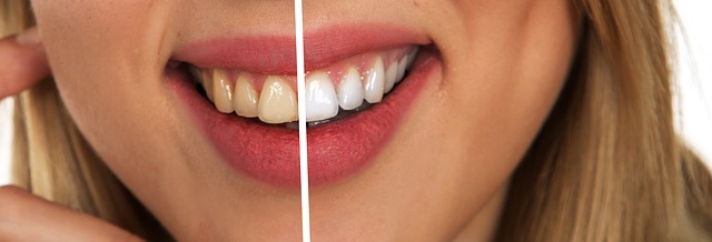 odstíny zubů